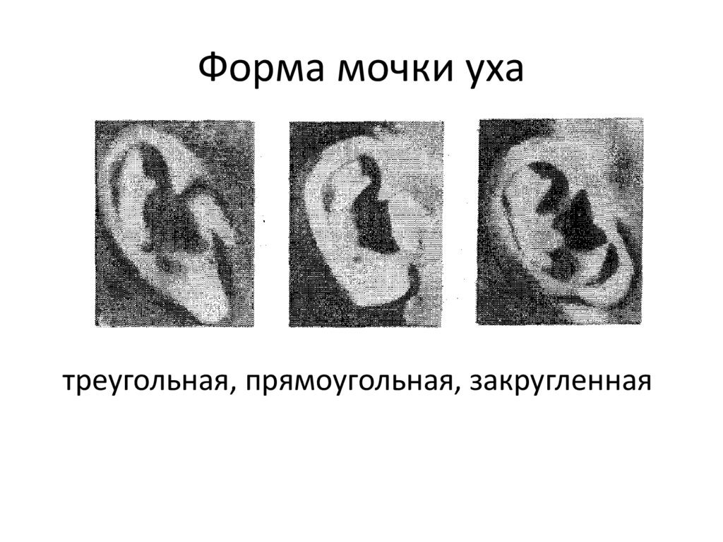 Мочки ушей о чем говорят. Форма мочки уха о чем говорит. Форма мочки уха криминалистика.