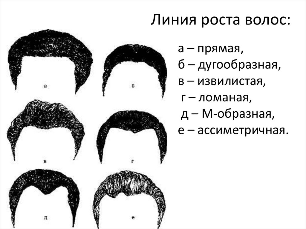 Расположите типы мужских голосов по мере высоты. Габитоскопия в криминалистике. Линия роста волос у мужчин криминалистика. Типы линии роста волос у мужчин. Форма линии роста волос.
