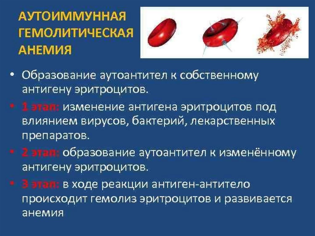 Анемия гемолитического типа. Аутоиммные анемия патогенез. Аутоиммунное заболевание крови гемолитическая анемия. Аутоиммунная гемолитическая анемия клиника. Клинические особенности аутоиммунной гемолитической анемии.