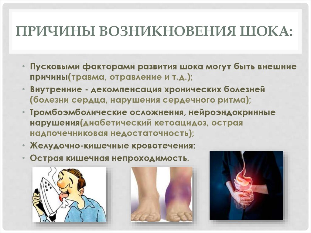 Шок и его типы - online presentation
