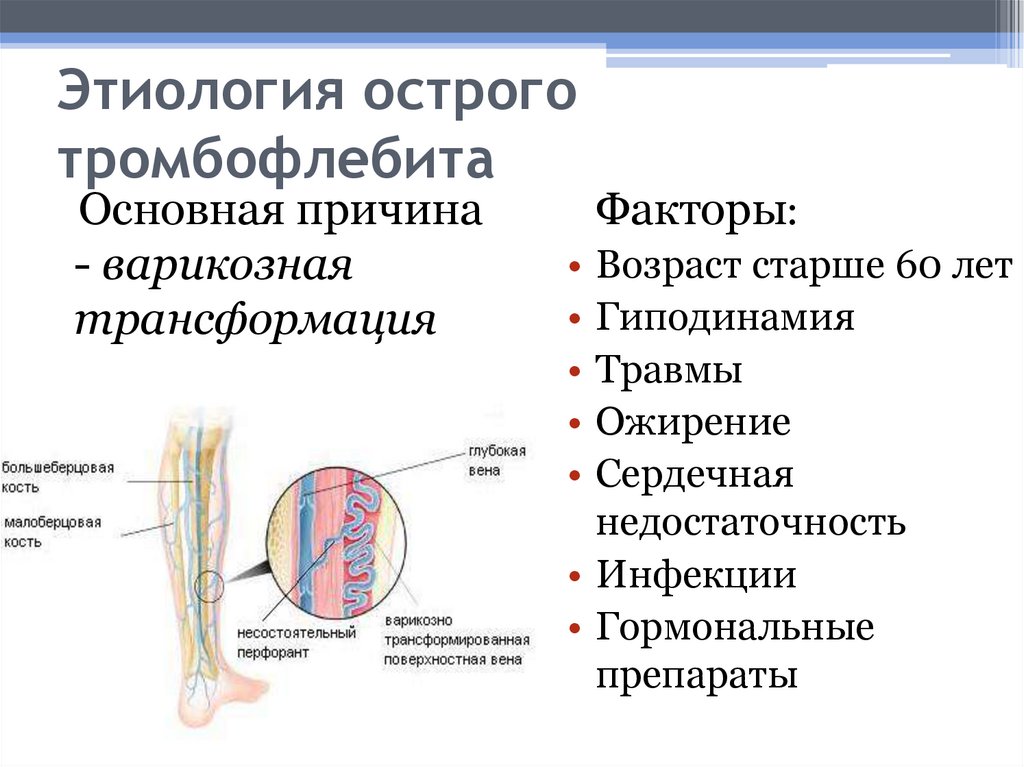 Причины возникновения тромбоза. Тромбоз поверхностных вен патогенез. Острый поверхностный тромбофлебит этиология. Тромбофлебит поверхностных вен этиология. Острый поверхностный тромбофлебит нижних конечностей.
