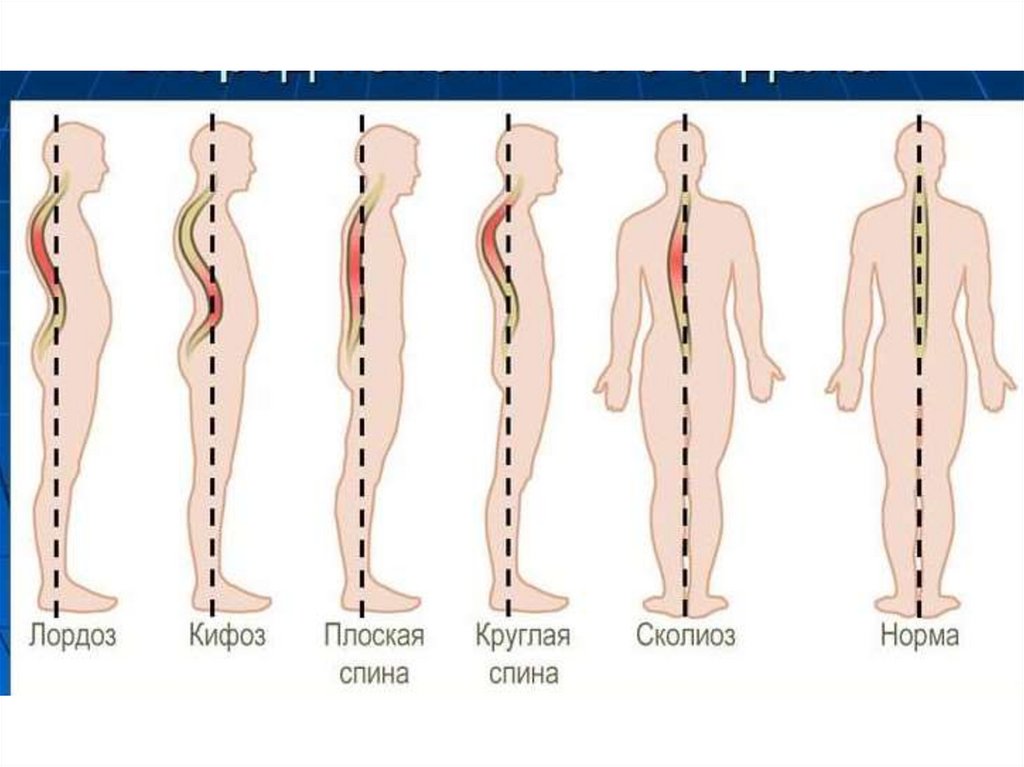 Лордоз отделы позвоночника