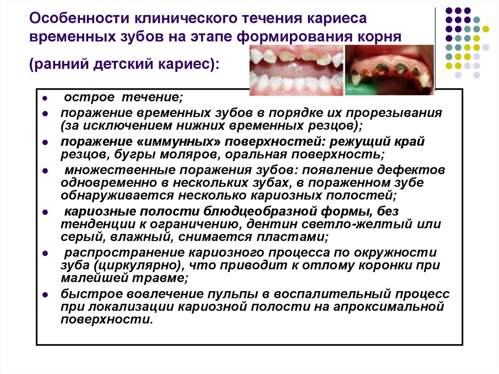 Особенности клинического течения кариеса временных зубов на этапе формирования корня (ранний детский кариес):