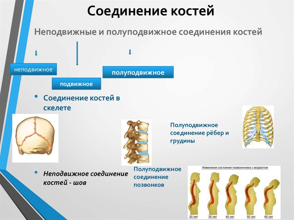 Подвижное полуподвижное и неподвижное соединение костей. Полуподвижное соединение костей. Неподвижное соединение костей. Неподвижные полуподвижные и подвижные соединения костей.