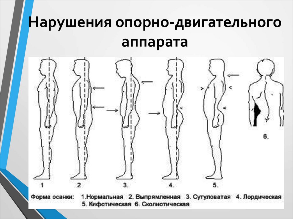 Нарушение двигательной системы. Гигиена опорно-двигательного аппарата. Возрастная анатомия и физиология опорно-двигательного аппарата. Возрастные изменения опорно-двигательного аппарата.