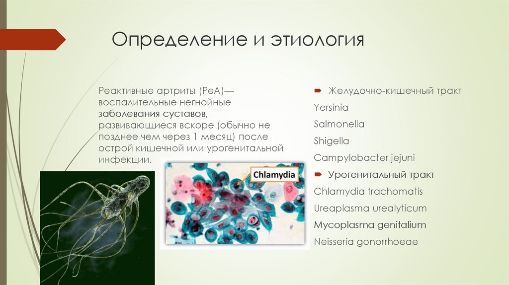 Реактивные артриты презентация