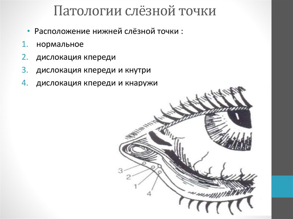 Нижняя слезная точка глаза. Схема строения слезной системы. Слезные железы у собак