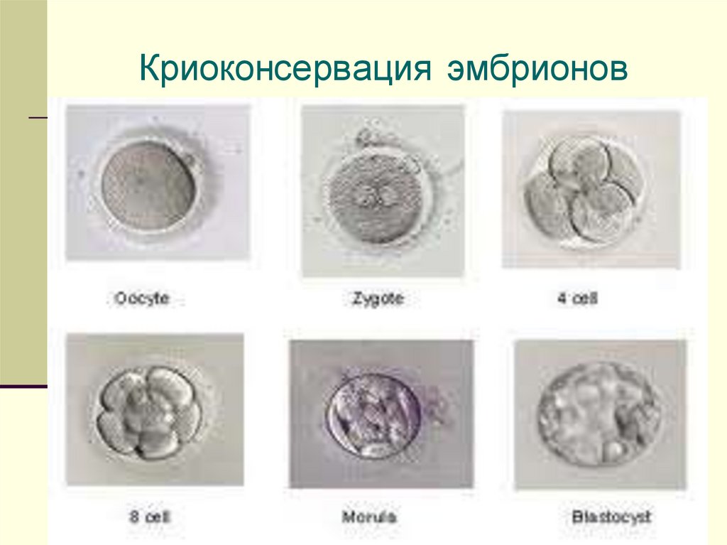 4 5 день. Зигота бластоциста. Эмбрион бластоциста. Морула и бластоциста. Эмбрион ранняя бластоциста.