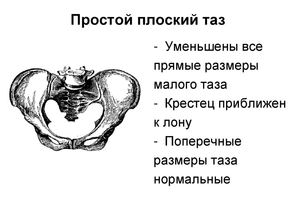 Узкий таз. Простой плоский таз. Простой суженный таз. Простой плоский таз Размеры. Плоско суженный таз.