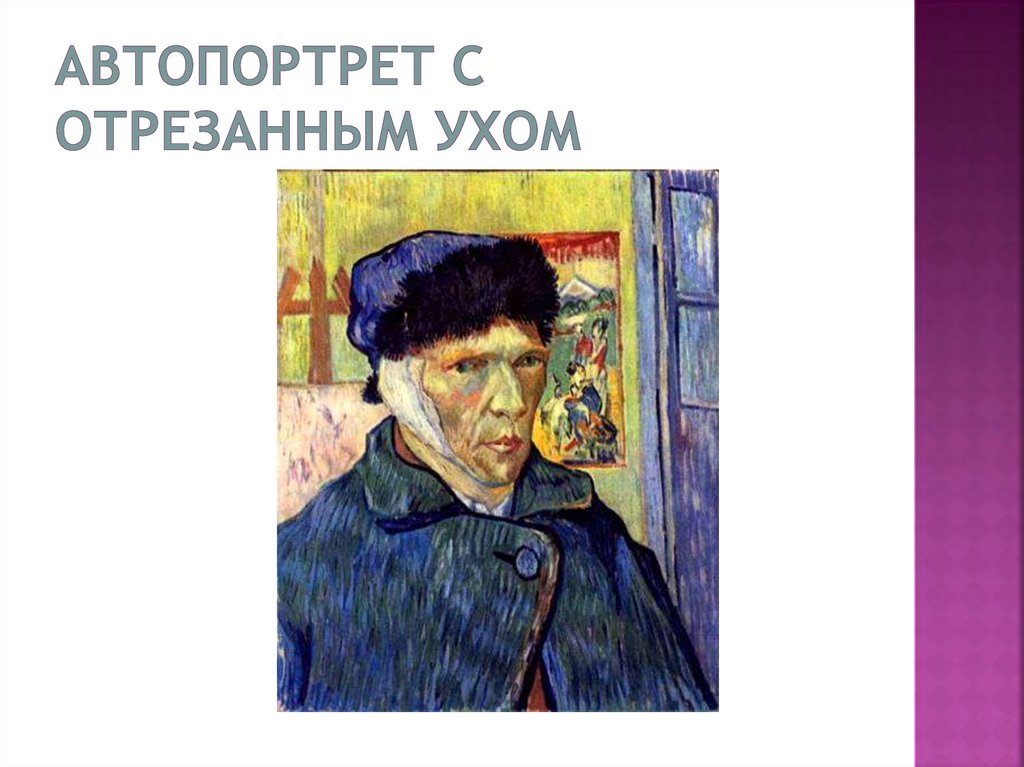 Синдром ван гога. «Автопортрет с отрезанным ухом и трубкой». 1889 Г.. Человек с отрезанным ухом картина.