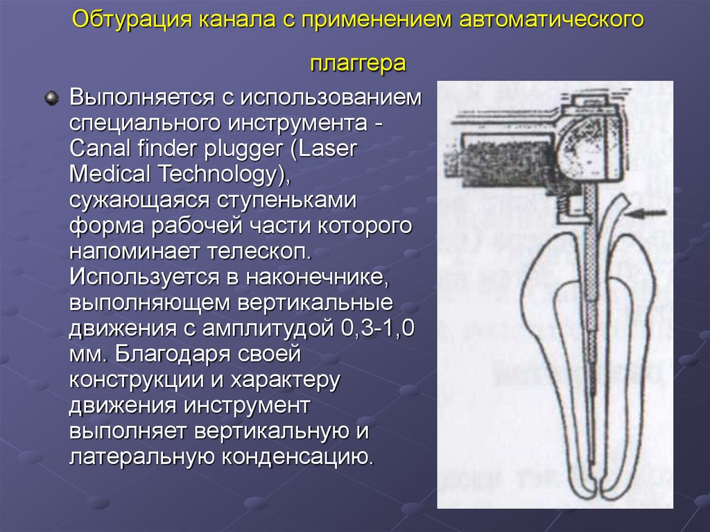 Автоматическое применение