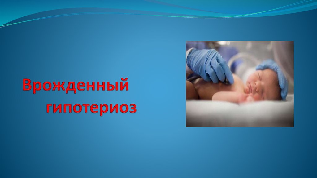 Врожденный гипотериоз