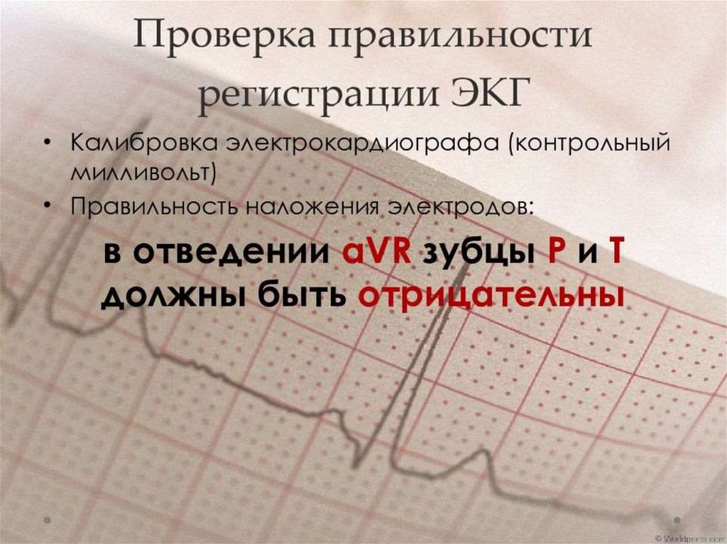 Основы экг презентация