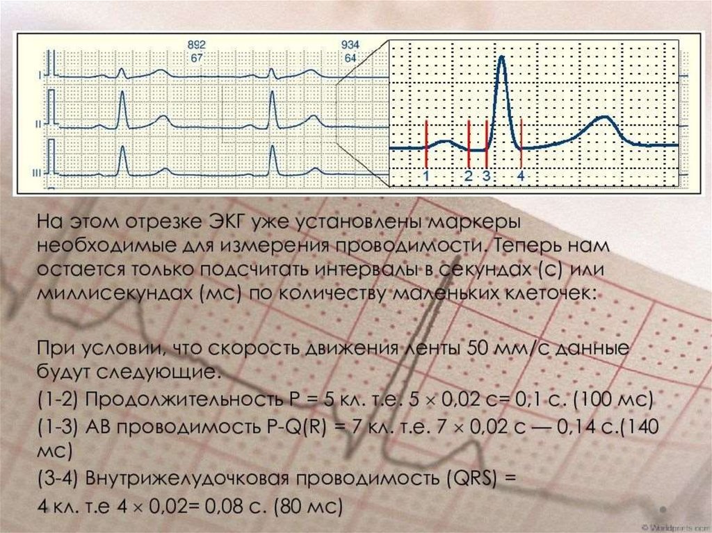 Презентация основы электрокардиографии