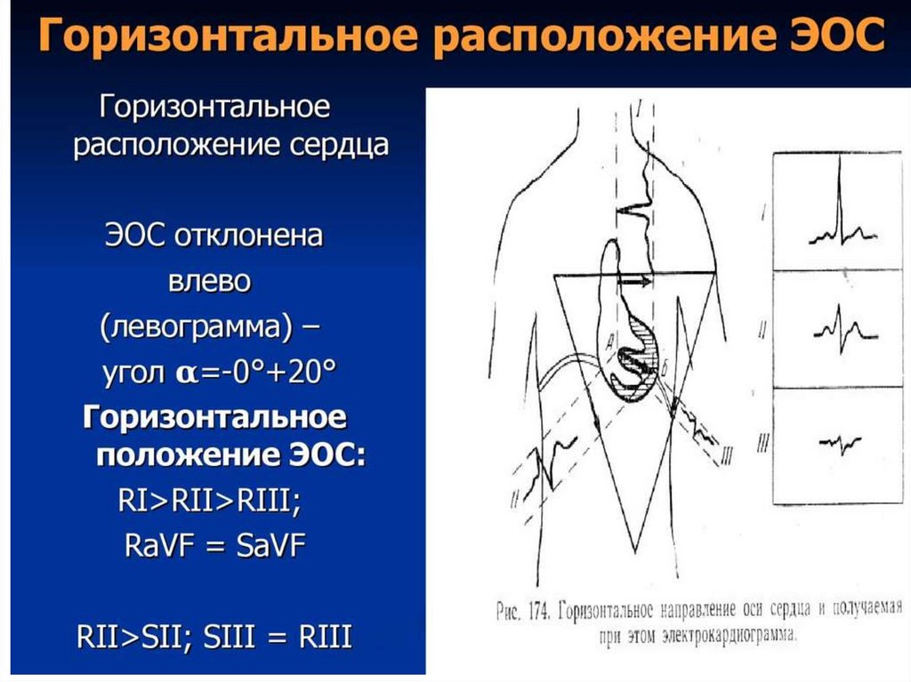 Презентация пропедевтика экг