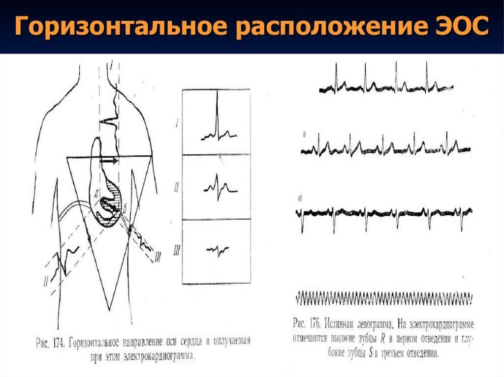 Презентация пропедевтика экг