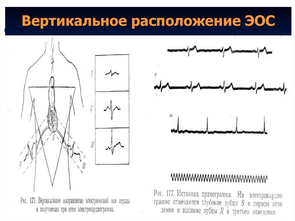 Презентация пропедевтика экг