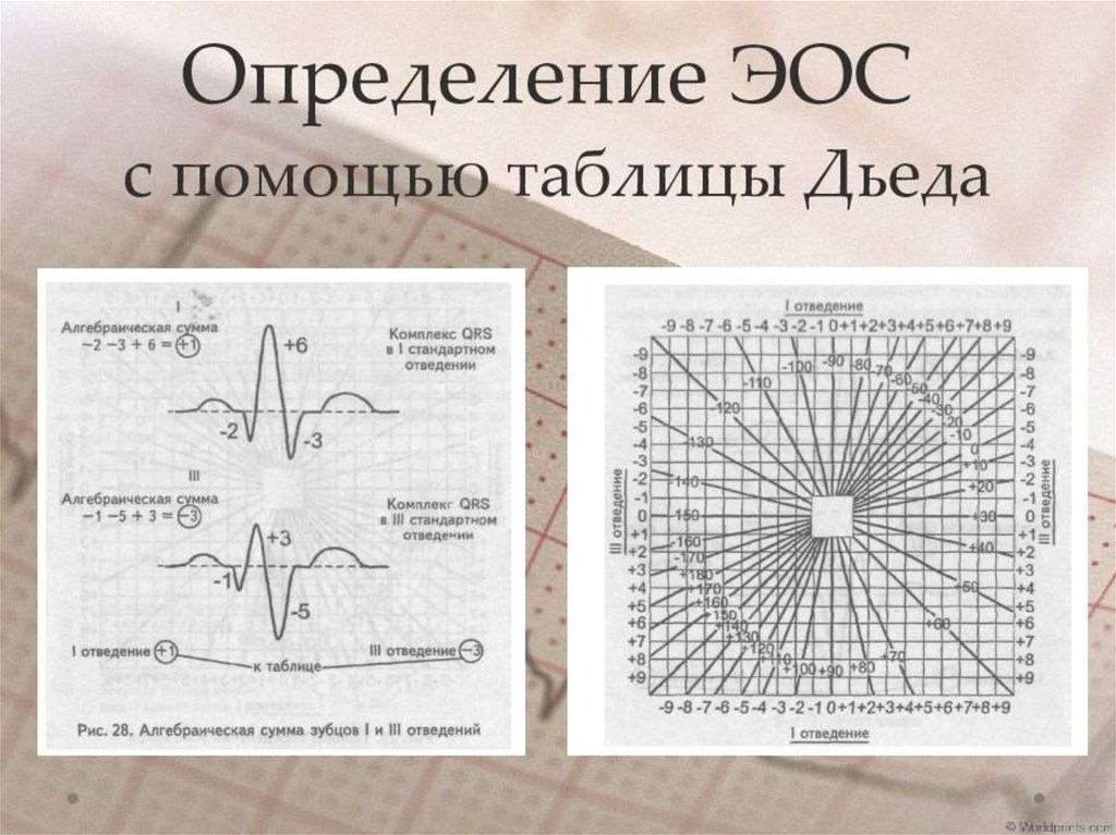 Диаграмма дьеда экг