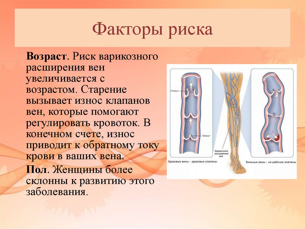 Варикозная болезнь вен нижних конечностей код