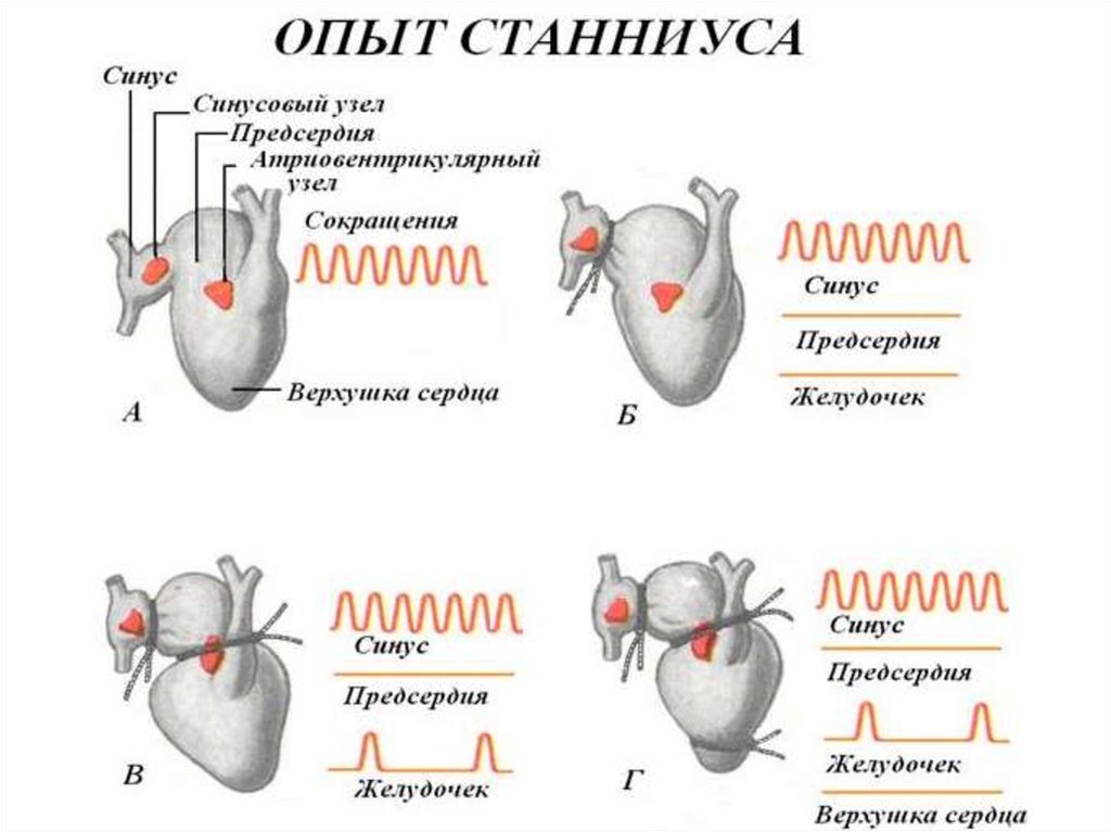 Схема наложения лигатур