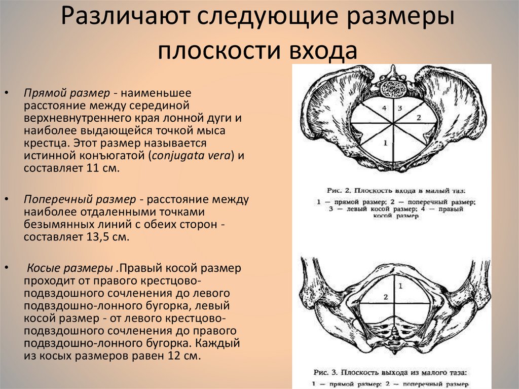 Акушерские размеры таза на рисунке