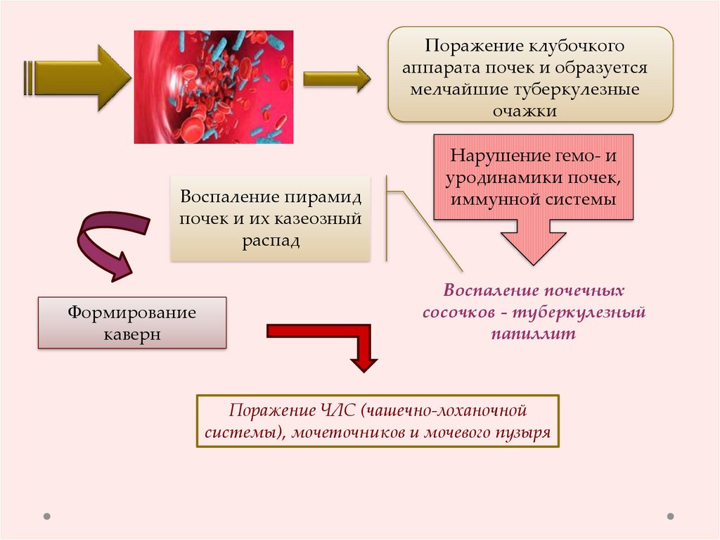 Туберкулез мочевыделительной системы презентация