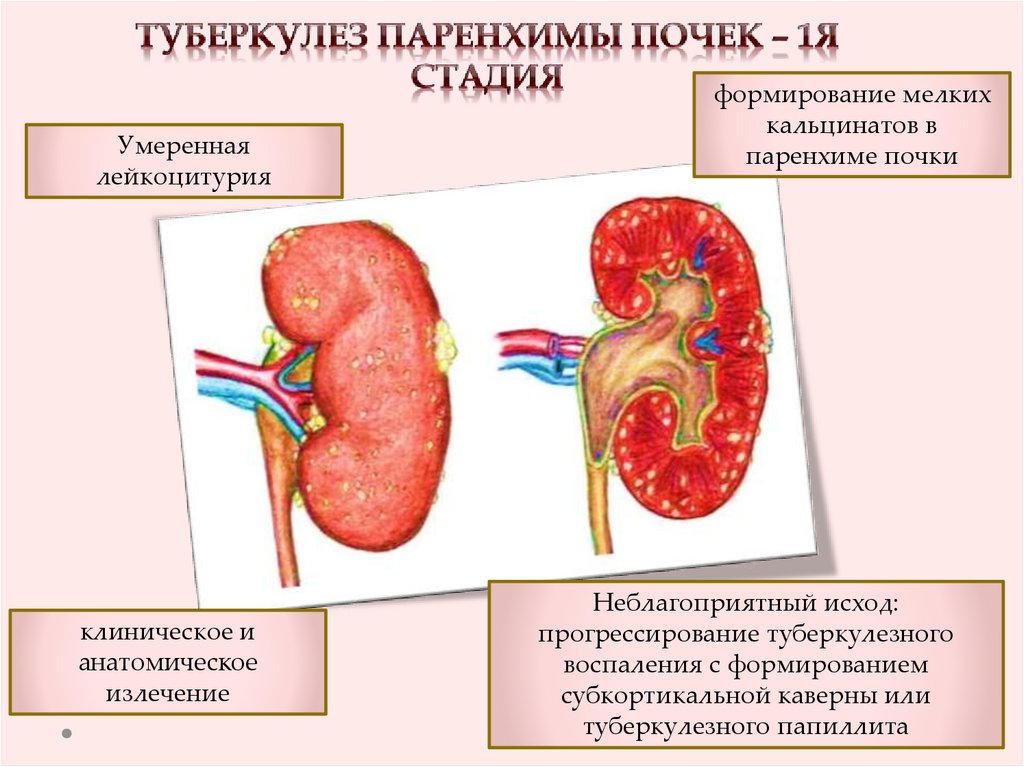 Препараты почки и мочевыводящие пути