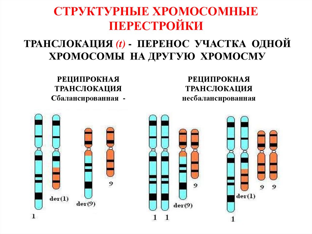 Местоположение генов в хромосоме. Транслокация хромосом схема. Сбалансированная и несбалансированная транслокация. Транслокация кариотип. Робертсоновская транслокация.