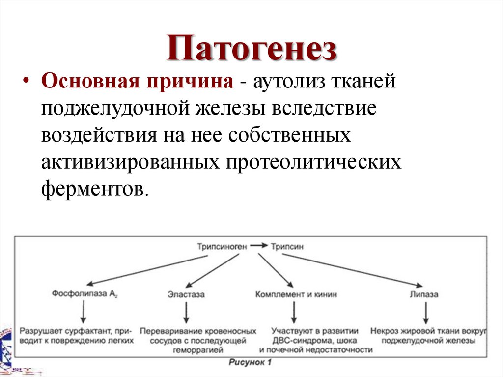 Острый панкреатит. Этиология, патогенез, клиника и диагностика ...