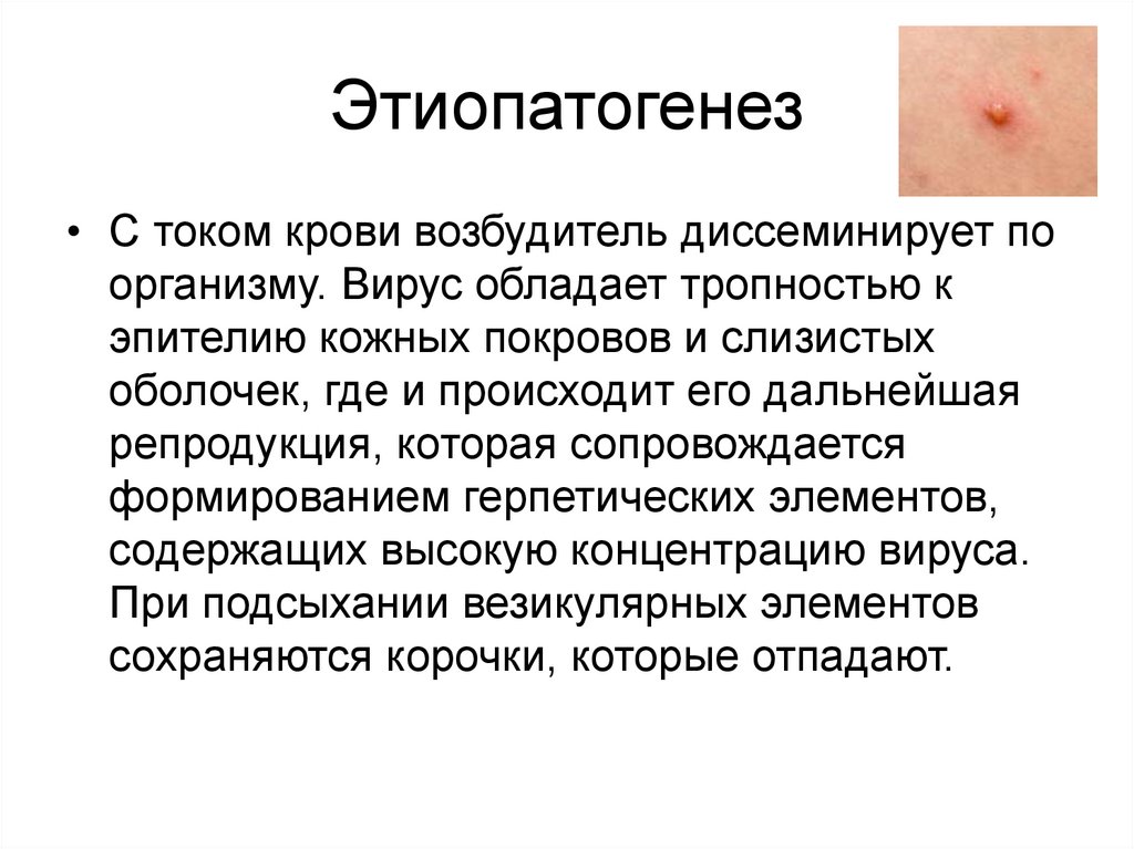 Этиопатогенез