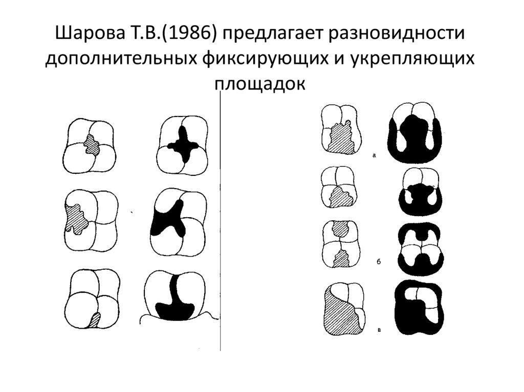 Типы полостей. Дефекты закладки зубов. Ортопедическое лечение дефектов твердых тканей зубов вкладками. Классификация дефектов твердых тканей зубов.