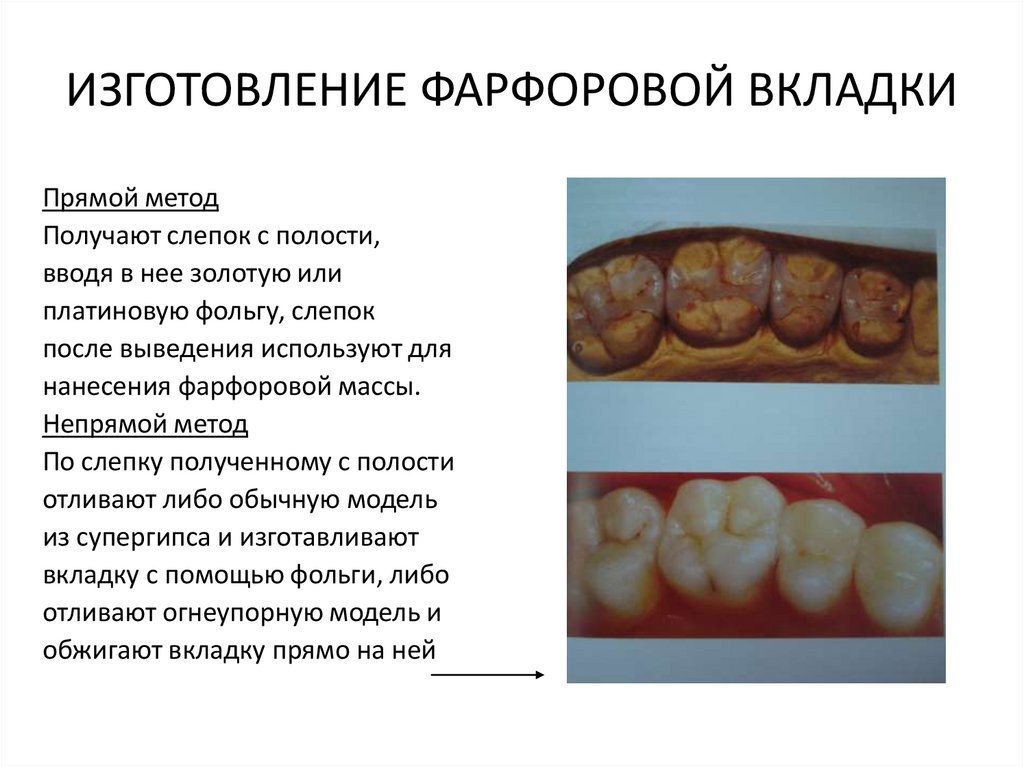 Презентация вкладки в стоматологии