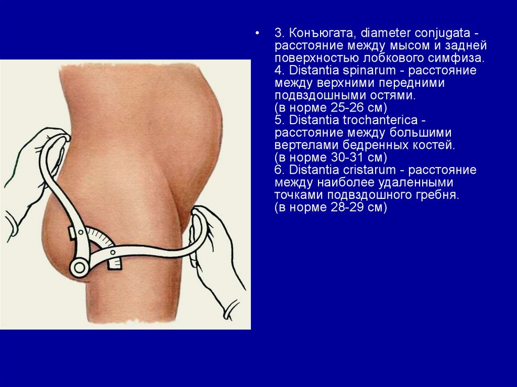 Ответ на заключение прокуратуры на проект нпа