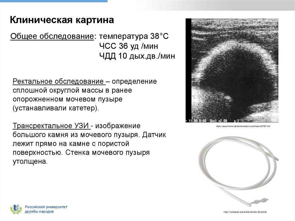 Клиническая картина