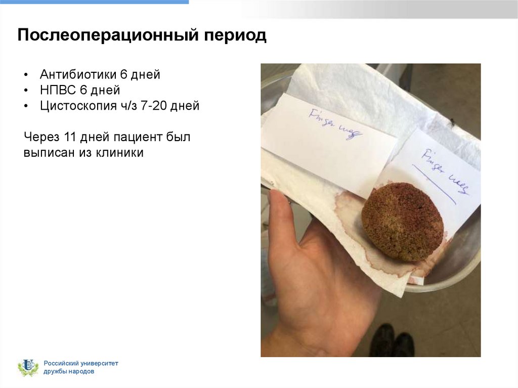 Послеоперационный период