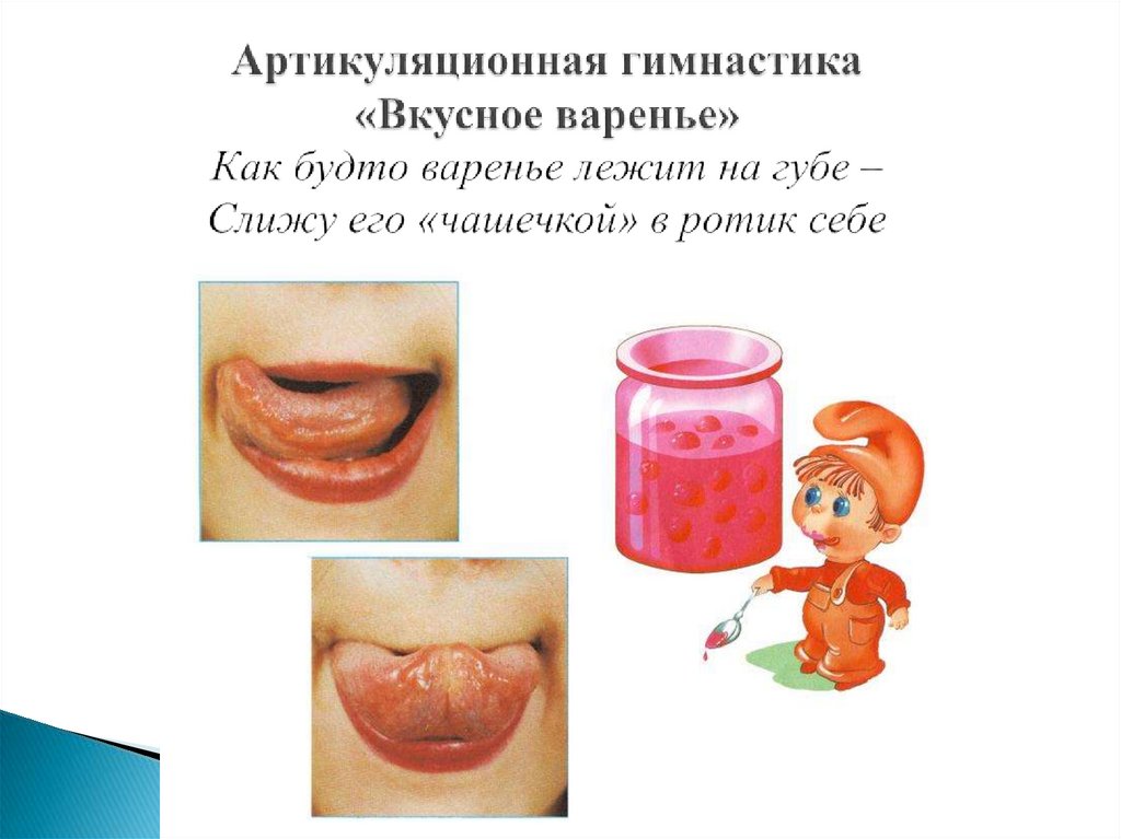 Артикуляционная гимнастика «Вкусное варенье» Как будто варенье лежит на губе – Слижу его «чашечкой» в ротик себе