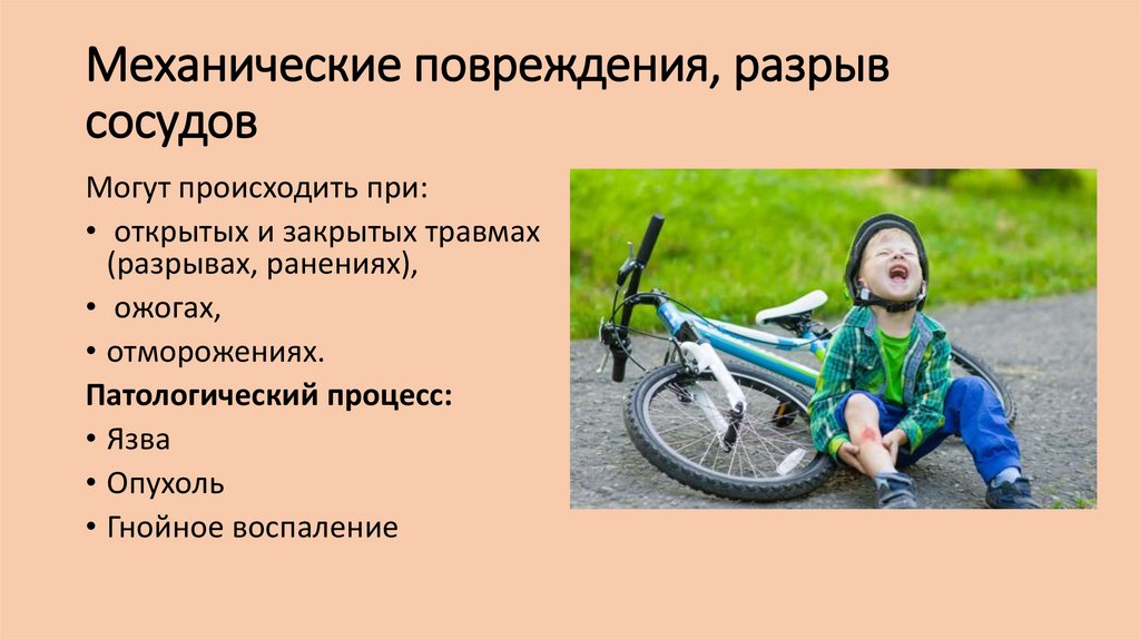 Механические повреждения, разрыв сосудов