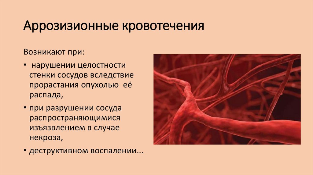 Тромборезистентность сосудистой стенки обусловлена