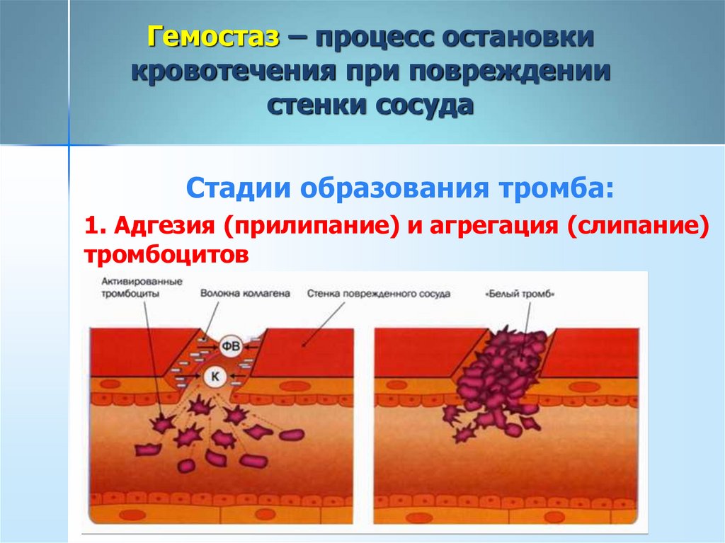 Тромбоциты при кровотечении. Схема образования тромба. Процесс остановки кровотечения. Тромбоциты образование тромба. Этапы образования тромба.