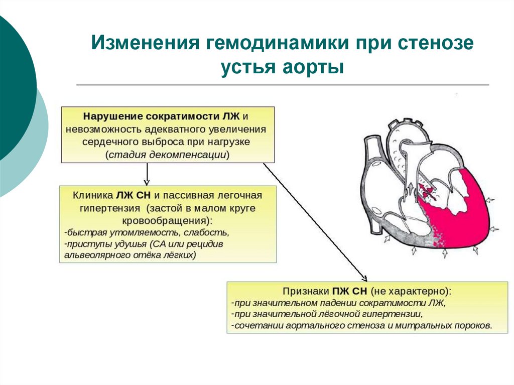 Патогенез аортального стеноза схема