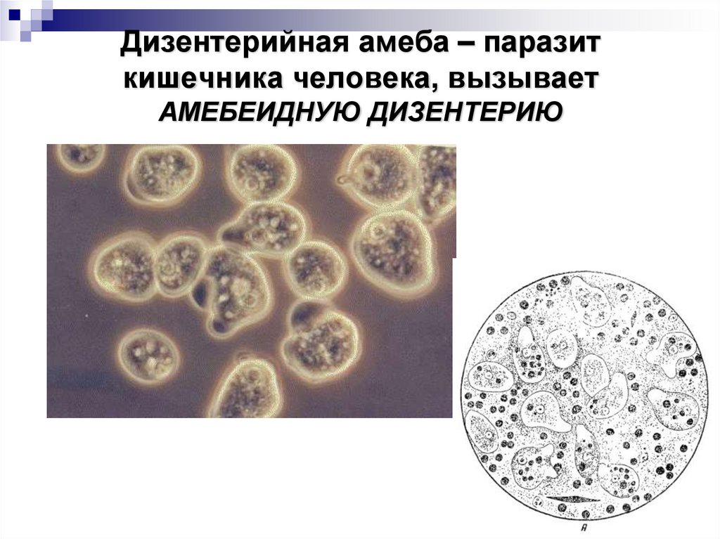 Дизентерийная амеба – паразит кишечника человека, вызывает АМЕБЕИДНУЮ ДИЗЕНТЕРИЮ