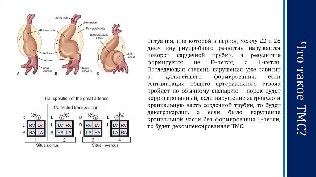 Что такое ТМС?