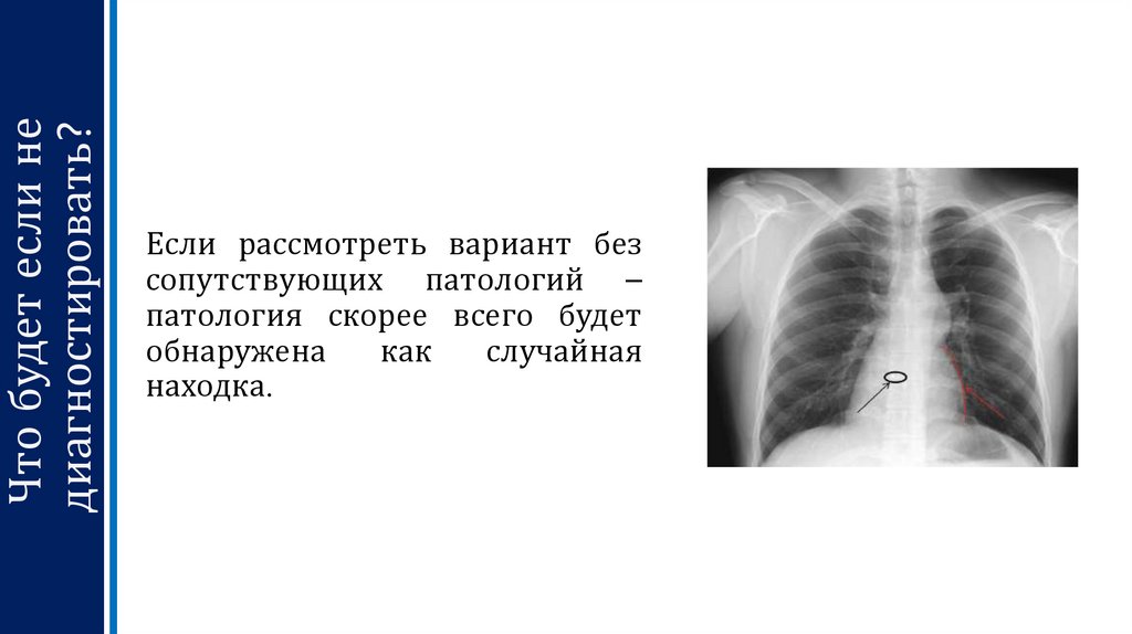 Что будет если не диагностировать?