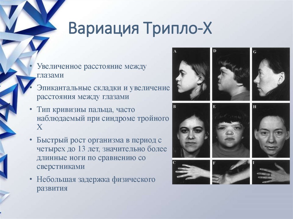 Мутации в аутосомных хромосомах - презентация онлайн