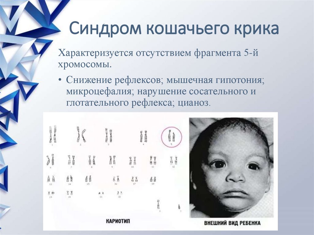 Мутации в аутосомных хромосомах - презентация онлайн
