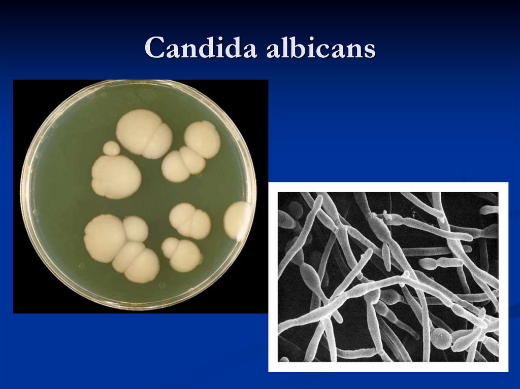 Candida albicans лечение. Кандида альбиканс микроскопия. Биопленка Candida albicans. Кандида альбиканс адгезия грибов.