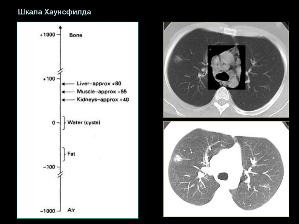 Шкала хаунсфилда презентация