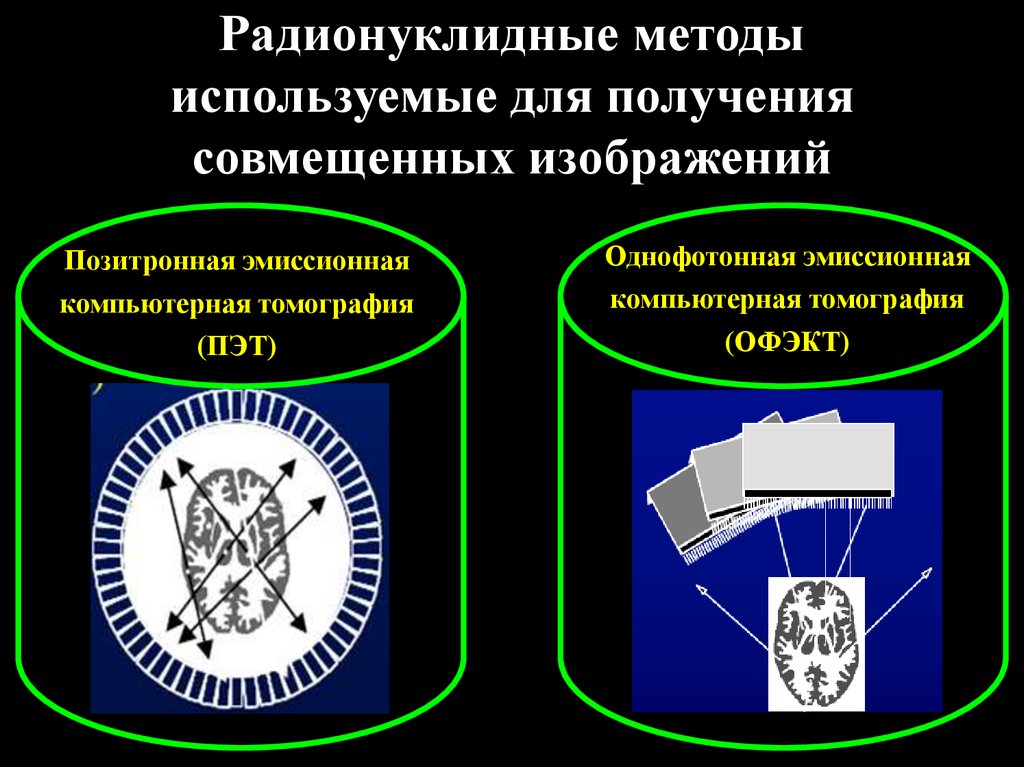 Для получения изображения в компьютерной томографии используется