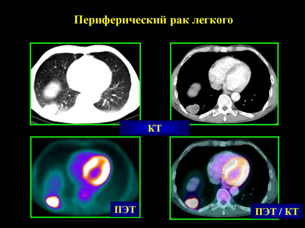 Презентация пэт кт