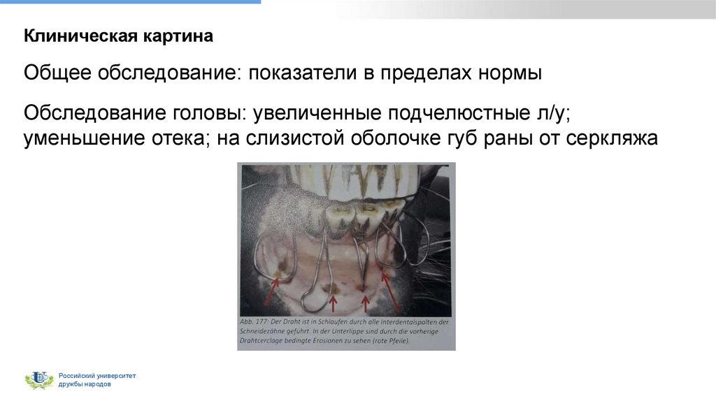 Клиническая картина